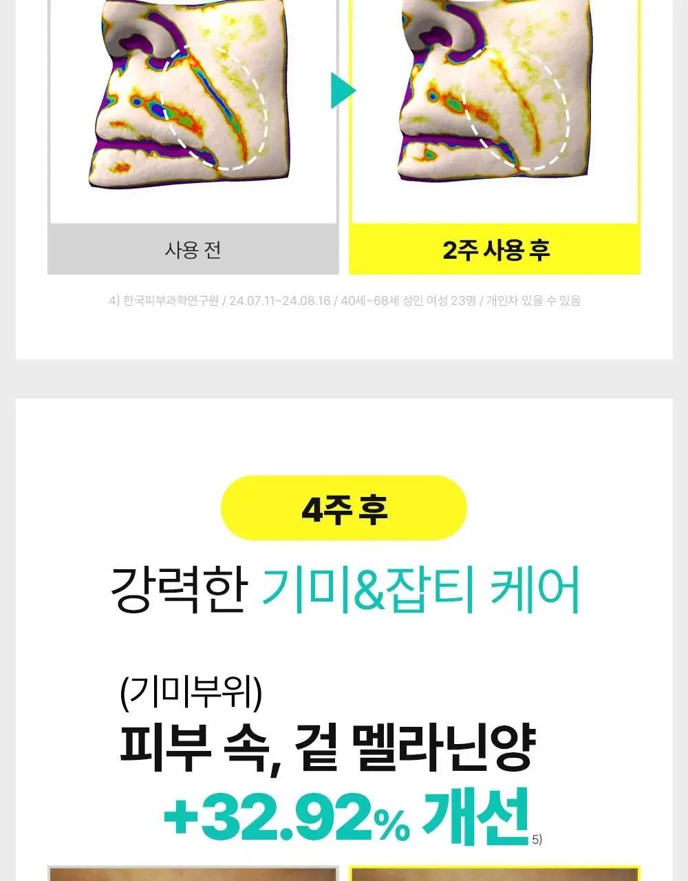 [아이백패치] 더마펌 비타액티브 마이크로크리스탈 패치플러스 3종 택1 상세페이지 24